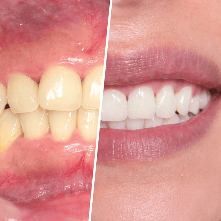 Paciente de Estética Dental