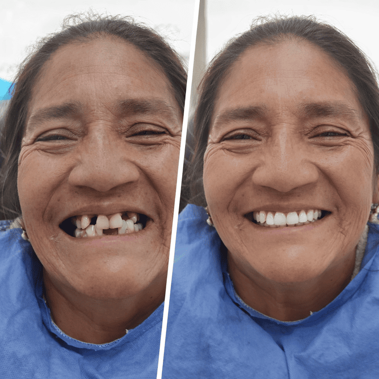 Paciente de Rehabilitación Oral